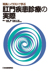 写真とイラストで学ぶ肛門疾患診療の実際