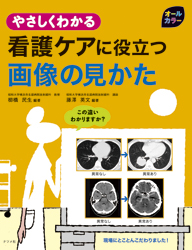 やさしくわかる看護ケアに役立つ画像の見かた